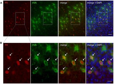Prenatal Valproate Exposure Differentially Affects Parvalbumin-Expressing Neurons and Related Circuits in the Cortex and Striatum of Mice